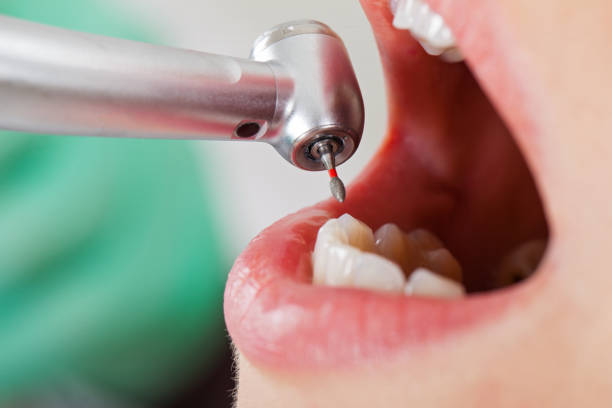 Best Emergency Treatment for Toothache in Baker, LA